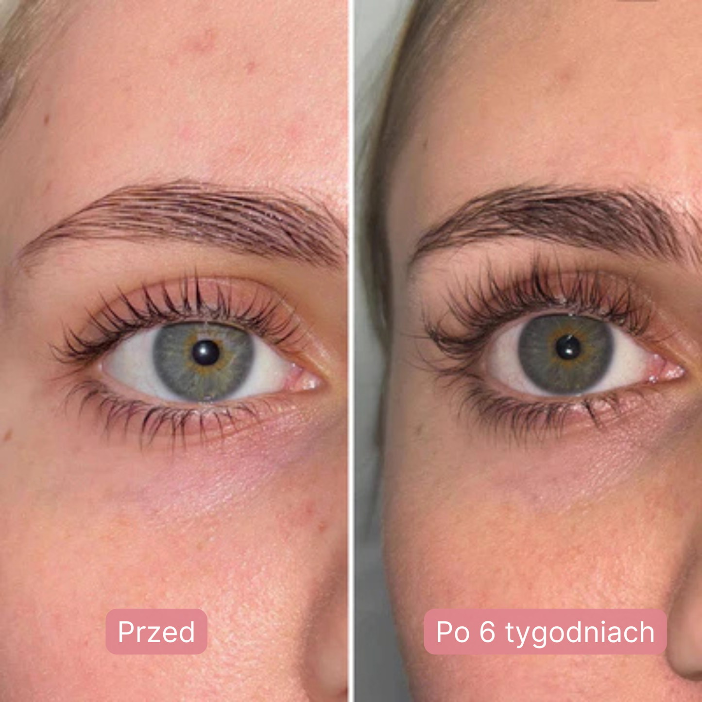 Serum na Porost Rzęs